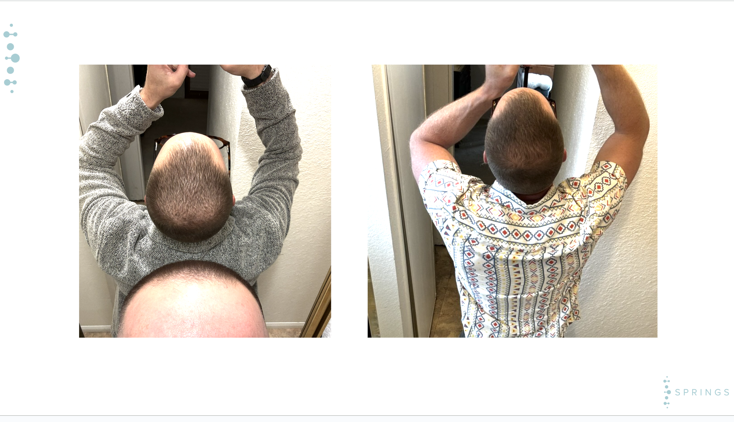 Before and After Results